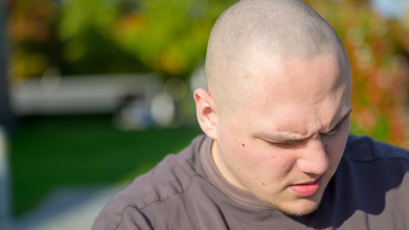 bald guy head