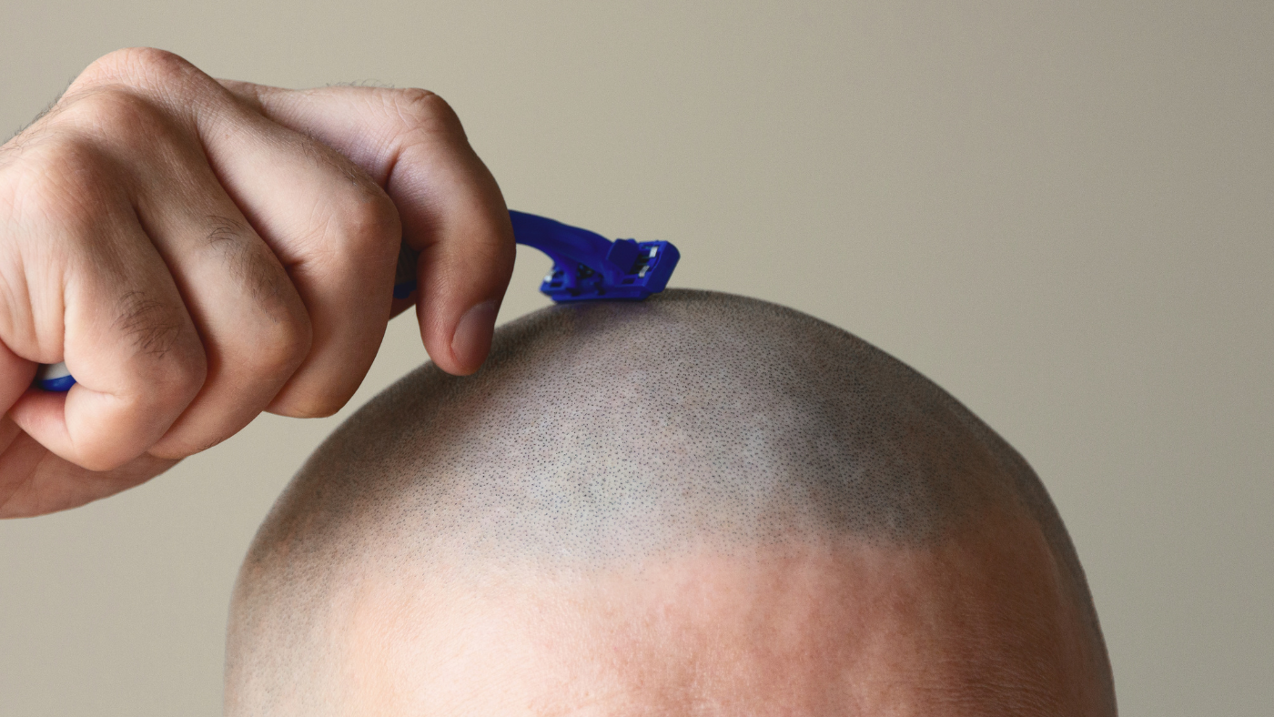 bald head