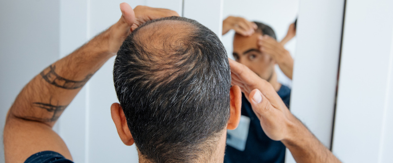 Why i am losing hair?